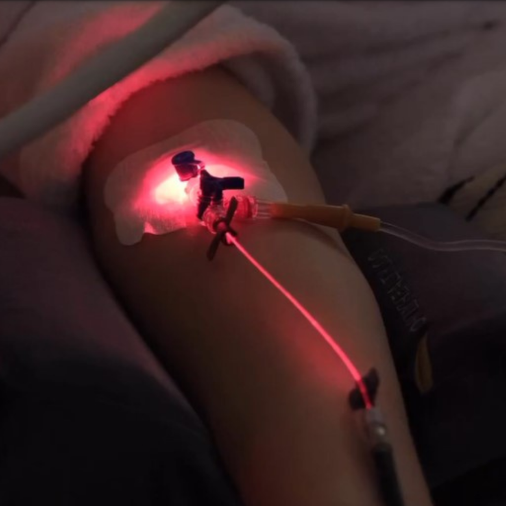 Intravenous laser therapy